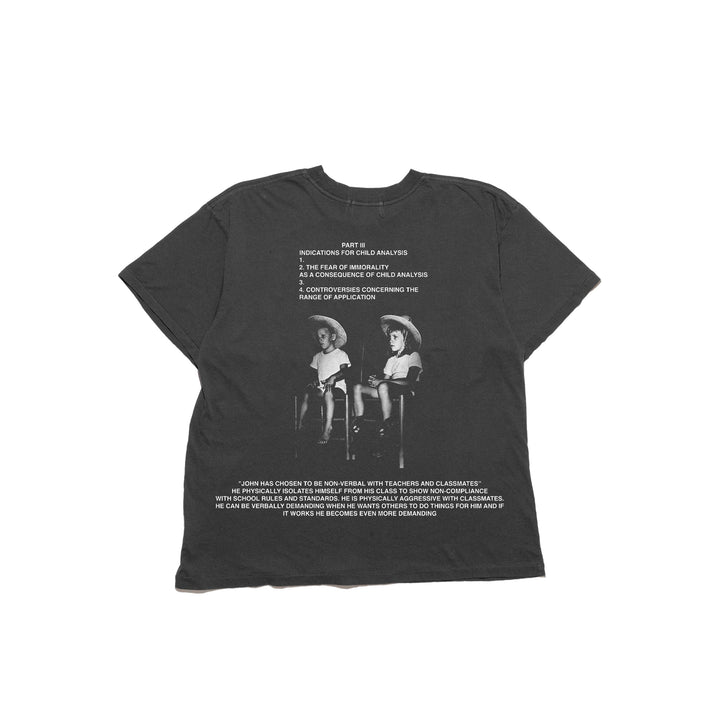 ABNORMALITIES IN EYE CONTACT T-SHIRT